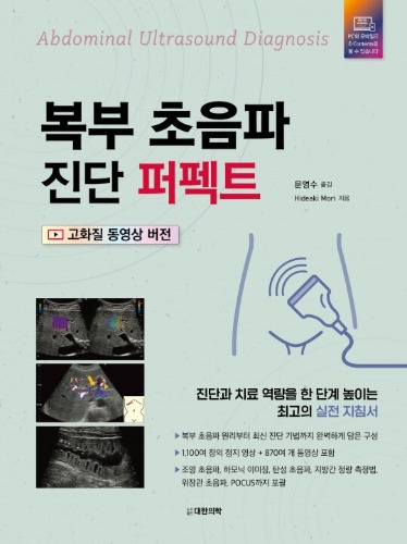 복부초음파 진단 퍼펙트
