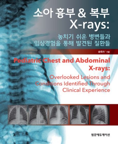 소아 흉부 복부 X-rays(엑스레이사진)