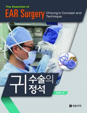 귀 수술의 정석