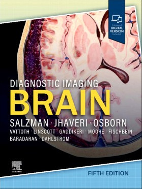 Diagnostic Imaging: Brain-5판