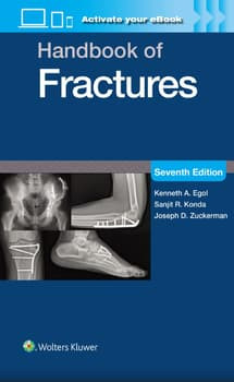 Handbook of Fractures-7판