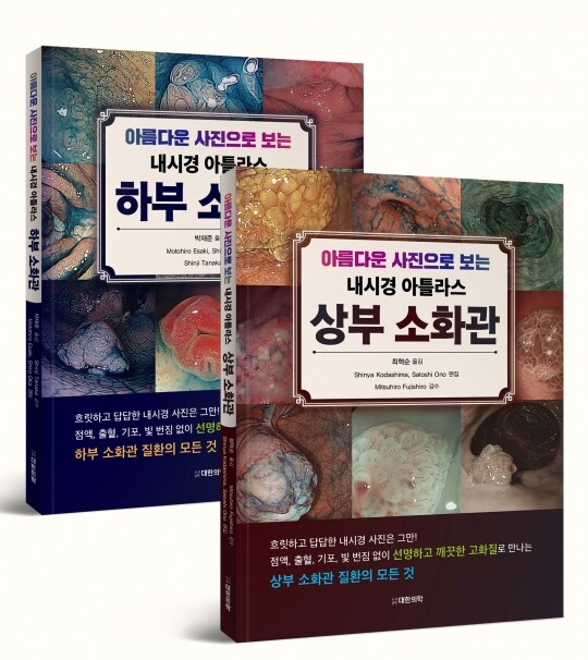 아름다운 사진으로 보는 내시경 아틀라스 상부소화관/하부소화관 SET