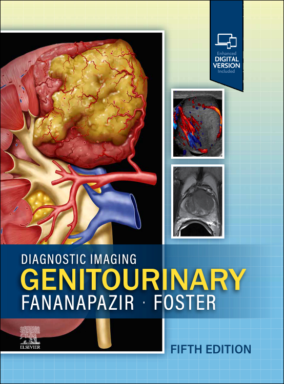 Diagnostic Imaging: Genitourinary-5판