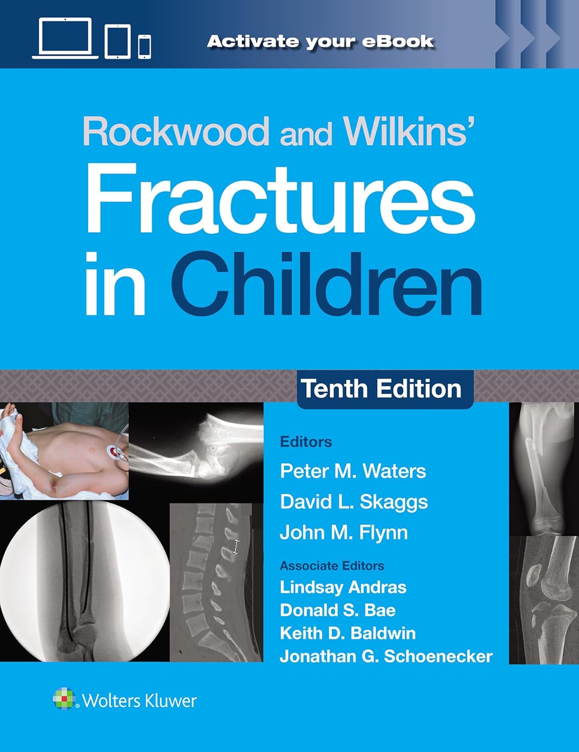 Rockwood and Wilkins` Fractures in Children-10판(Print + eBook with Multimedi)