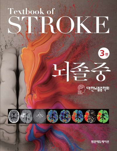 뇌졸중-3판