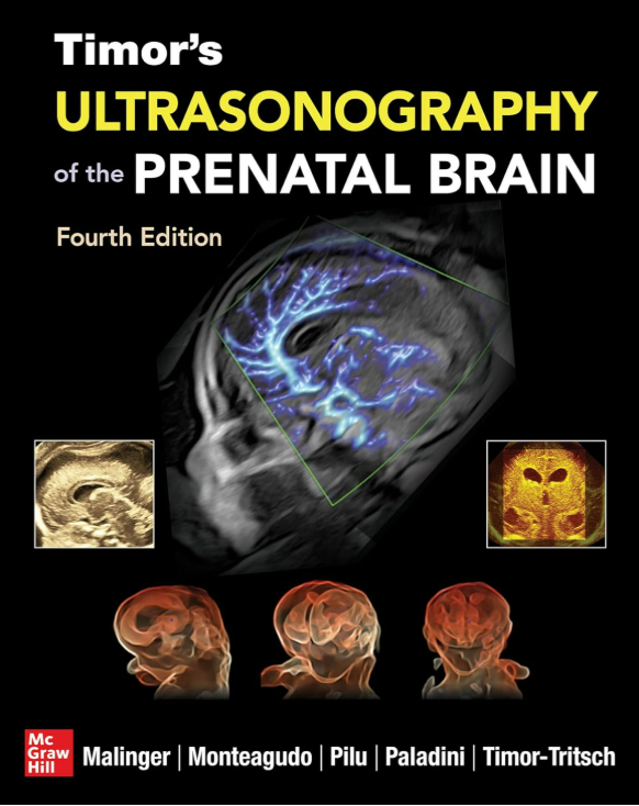 Timor`s Ultrasonography of the Prenatal Brain-4판