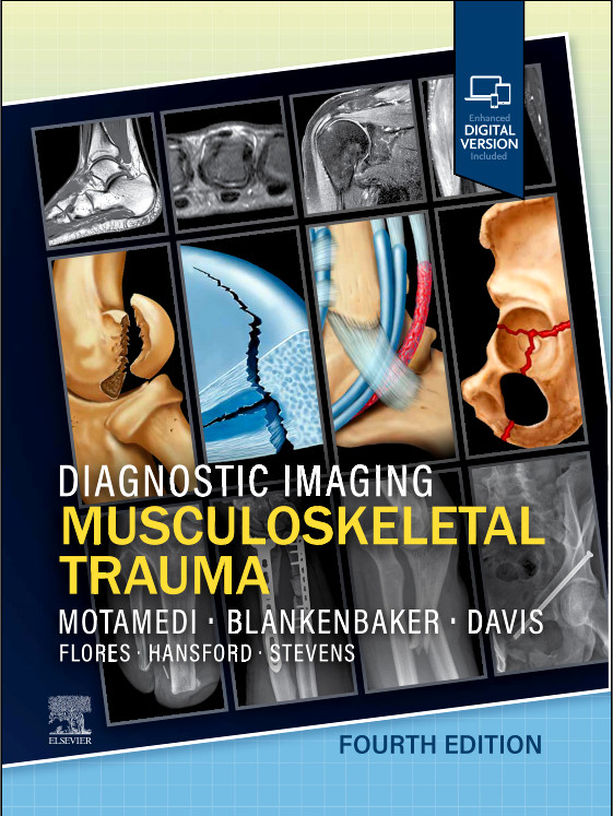 Diagnostic Imaging: Musculoskeletal Trauma-4판