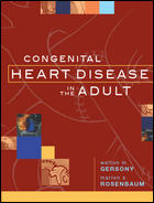Congenital Heart Disease Adult
