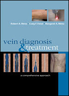 Vein Diagnosis and Treatment A Comprehensive Approach