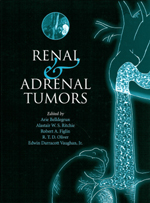 Ranal  and Adrenal Tumors
