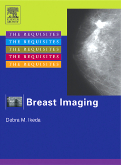 Breast Imaging - The Requisites