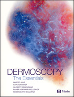 Dermoscopy : The Essentials