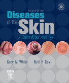 Diseases of the Skin A Color Atlas and Text-2판