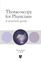 Thoracoscopy for Physicians : A Practical Guide