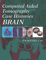 Computed Aided Tomography Case Histories  : Brain