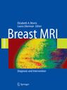 Breast MRI : Diagnosis and Intervention