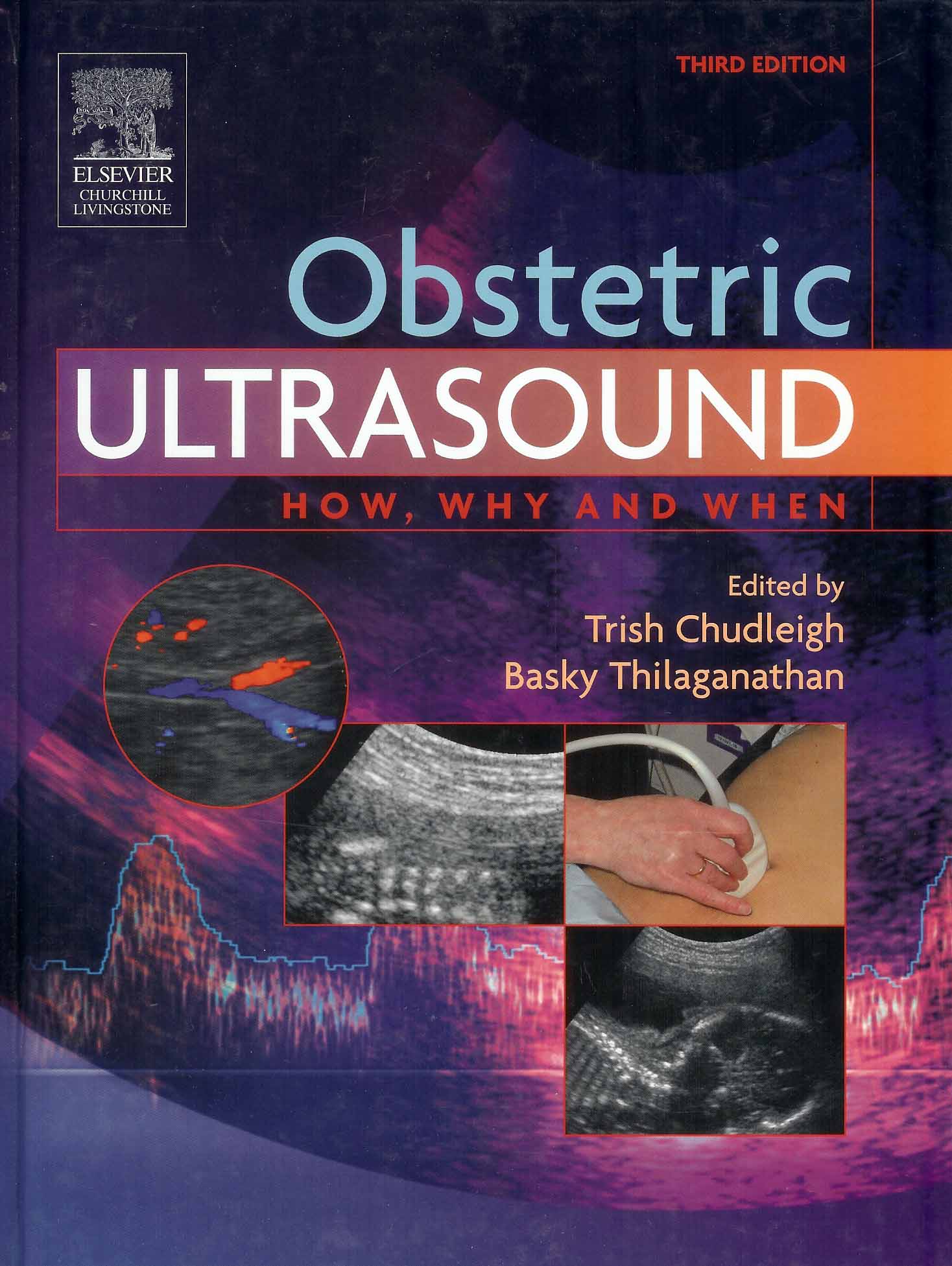 Obstetric Ultrasound:How Why and When 3/e