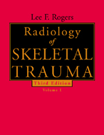 Radiology of Skeletal Trauma 2vols