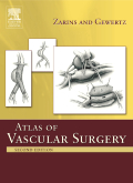 Atlas Of Vascular Surgery-2판