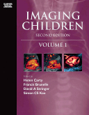 Imaging Children-2판