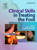 Clinical Skills in Treating the Foot-2판(2005)
