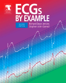 ECGs by Example-2판