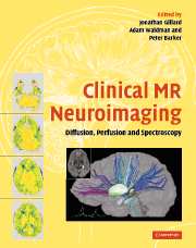 Clinical MR Neuroimaging : Diffusion Perfusion and Spectroscopy