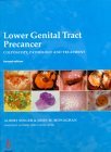 Lower Genital Cancer Precancer