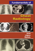 Fundamentals of Chest Radiology 2/e