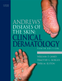 Andrews' Diseases of the Skin Clinical Dermatology  10/e