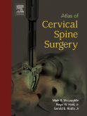 Atlas of Cervical Spine Surgery