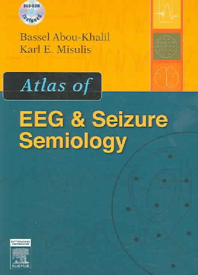 Atlas of EEG and Seizure Semiology-Textbook with DVD