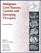 Malignant Liver Tumors: Current and Emerging Therapies-2판