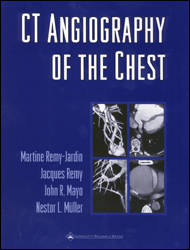CT Angiography of the Chest-1판