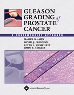 Gleason Grading of Prostate Cancer: A Contemporary Approach-1판