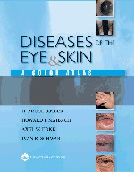 Diseases of the Eye and Skin-1판