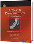 Advanced Reconstruction Foot and Ankle