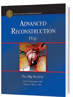 Advanced Reconstruction Hip  1/e