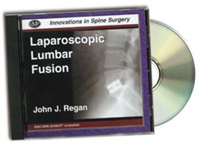 Laparoscopic Lumbar Fusion: Innovations in Spine Surgery CD-Rom