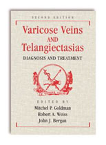 Varicose Veins and Telangiectasias: Diagnosis and Treatment