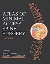 Atlas of Minimal Access Spine Surgery-2판