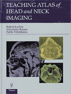 Teaching Atlas of Head and Neck Imaging : Teaching Atlas Series