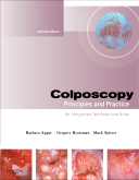 Colposcopy 2/e: Principles and Practice (Text with DVD)