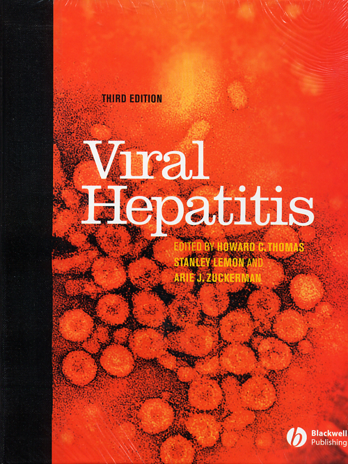 Viral Hepatitis  3/e