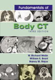 Fundamentals of Body CT  3/e