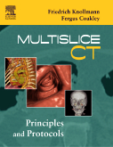 Multislice CT Principles and Protocols