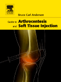 Guide to Arthrocentesis and Soft Tissue Injection 1/e