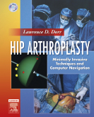 Hip Arthroplasty - Minimally Invasive Techniques and Computer Navigation Textbook with DVD-ROMS