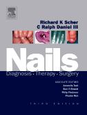 Nails-Diagnosis Therapy Surgery-3판