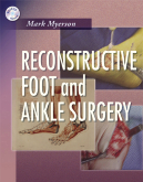Reconstructive Foot and Ankle Surgery (Book w/ CD)